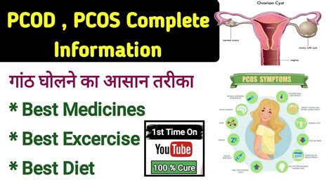 Pcod Pcos Best Homeopathic Medicines For Pcod Ovarian Cysts