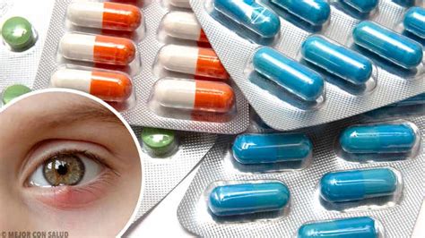 5 remedios para el síndrome del ojo seco mejor con salud