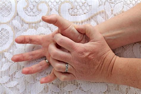 Itchy Fingers Symptoms Causes And Treatment