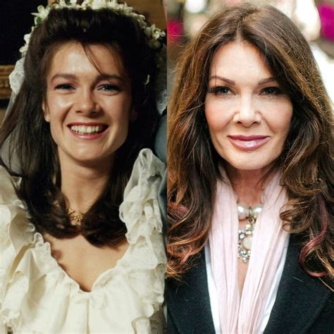 Lisa Vanderpump Plastic Surgery Before And After Celebrity Surgeries