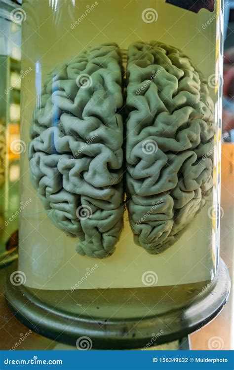 Human Brain In Glass Jar With Formaldehyde For Medical Studies Stock