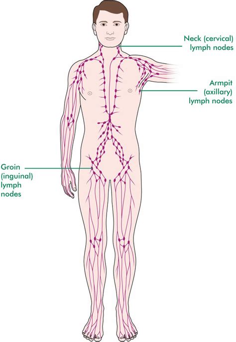 Swollen lymph nodes are your body's way of telling you that something's wrong. Swollen Lymph Nodes In Groin Male Pictures ...