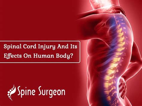 Spinal Cord Injury And Its Effects On Human Body Spine Surgeon