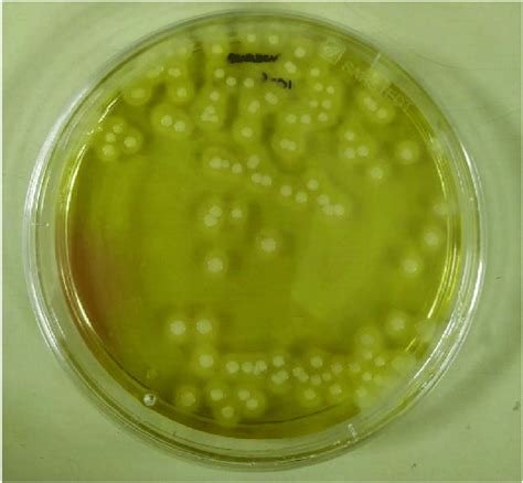 Mannitol Salt Agar Plate Inoculated With Staphylococcus Aureus Yellow