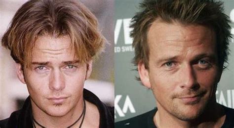 Has Sean Patrick Flanery Had Plastic Surgery