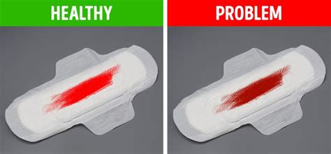 Blood Clots In Your Period The Emerging India