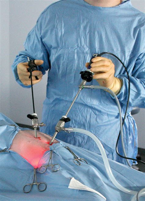 Laparoscopic Ovariectomy Keyhole Spay NDSR