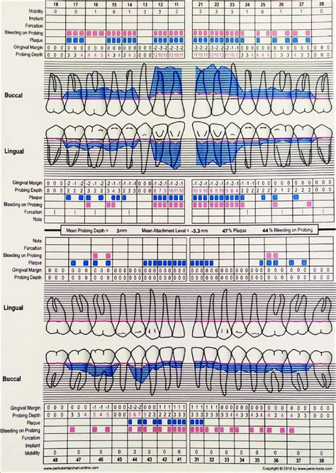 Periodontal Chart Preoperative Download Scientific Diagram