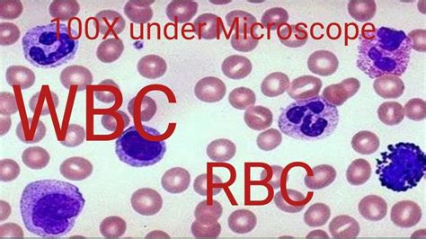 How to reduce wbc count. How to WBC count under Microscope - YouTube