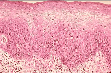 Stratified Squamousprotection Epithelial Tissue Histology Slides