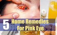 5 Home Remedies For Pink Eye – Natural Home Remedies & Supplements