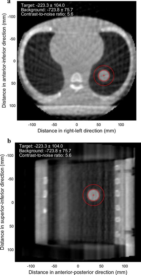 Illustration Of The Contrast To Noise Ratio Cnr Calculation For The