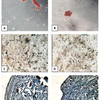 Adipogenic Osteogenic And Chondrogenic Differentiation Of Fibroblasts