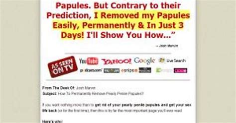 Download Pearly Penile Papules Removal Free Imgur