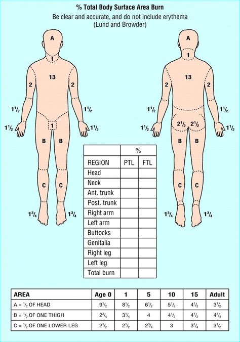 The Importance Of Lund And Browder Chart In Assessing Burn Severity Dona