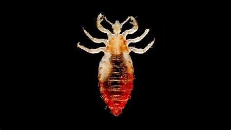 Body Lice Infestation Causes Symptoms And Diagnosis