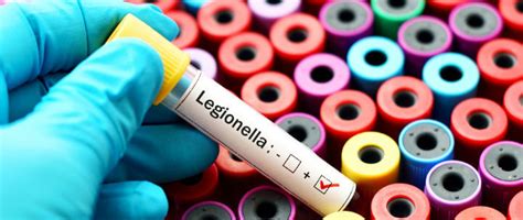 What Is Legionella Bacteria Water Treatment And Prevention Planning