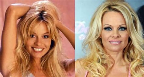 The Most Expensive Celebrity Plastic Surgeries Ever And How Much They Cost Buzzerilla In
