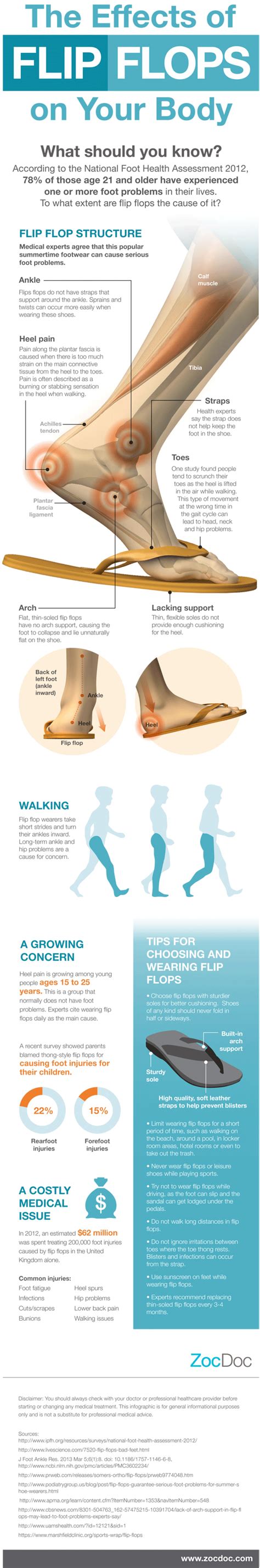 How Wearing Flip Flops Can Affect Your Health Infographic
