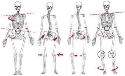 Four Types Of Posture Deviations Torso And Pelvic Elevation And