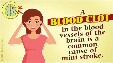 There Are Many Mini Stroke Symptoms That Must Not Be Ignored When They