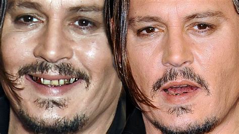 Johnny Depp Flashes His Gold And Stained Teeth After London Film
