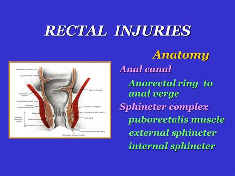 Ppt Colon And Rectum Injuries Powerpoint Presentation Free Download