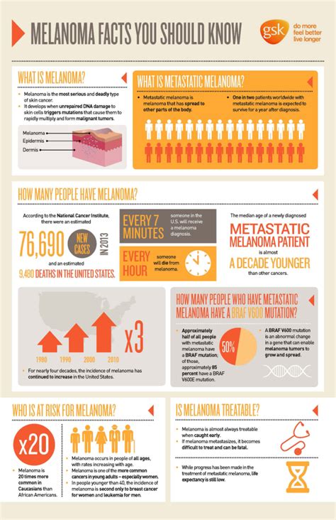 Melanoma Facts You Should Know Infographic