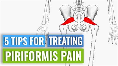 Treatment For Piriformis Pain Youtube