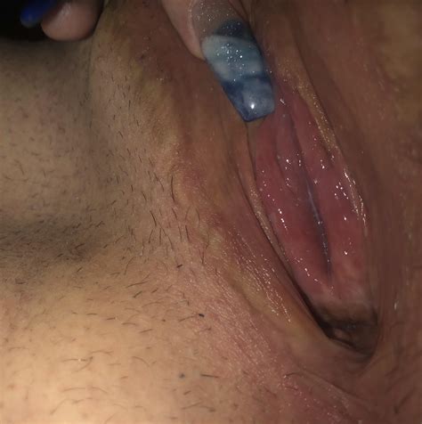 Link In Comments To See More Of My Tight Post Op Pussy Bet You Want To
