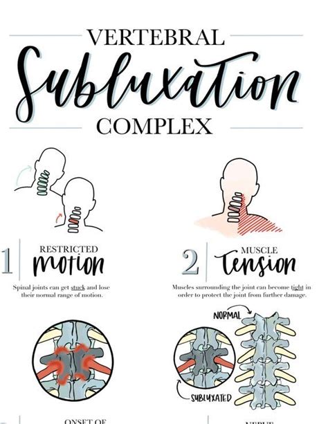 Vertebral Subluxation Complex Chiropractic Poster Watercolor Etsy