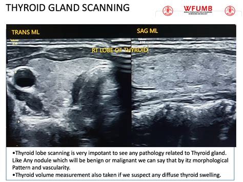Ultrasound The Best 12 Thyroid Gland Scanning Wfumb