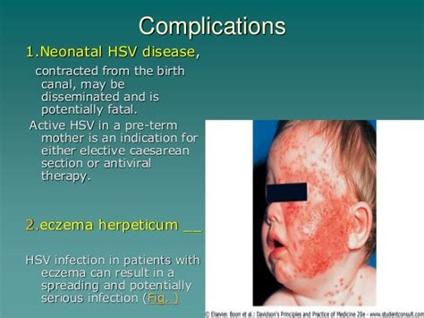 Viral Infections 4th Stage Students Dr Alaa Awn