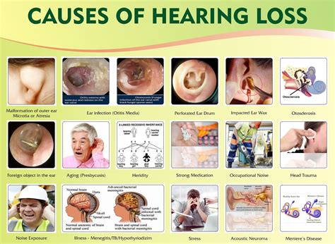 Hearing Aid What Are The Symptoms Of Hearing Loss