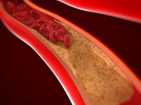The Role Of Arteries In The Circulatory System