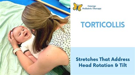 Torticollis 2 Stretches To Try At Home Youtube