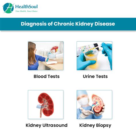 Chronic Kidney Disease Causes And Management Nephrology Healthsoul