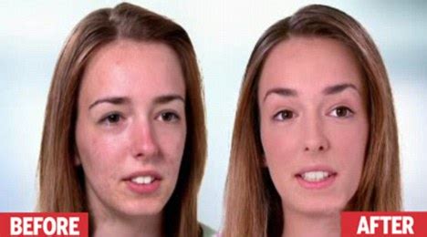It's like saying goodbye to an old friend who's been stealing your money and nobody except maybe your mom and the people who have had to carry you home drunk care that. Spot the difference: Ban on acne advert where the models ...