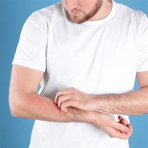 Symptoms And Causes Of Different Types Of Rashes Huntington Ny