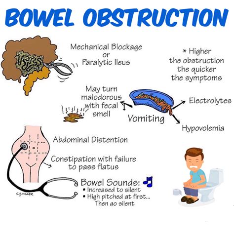 What diet do i need to follow? Bowel obstruction