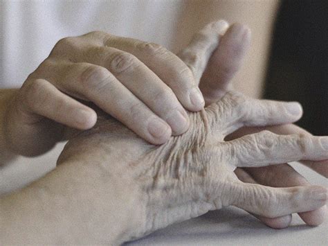 What Are The 4 Stages Of Rheumatoid Arthritis Learn More Here