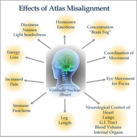 With Misaligned Neck Your Entire Spine Will Alter Its Position In An