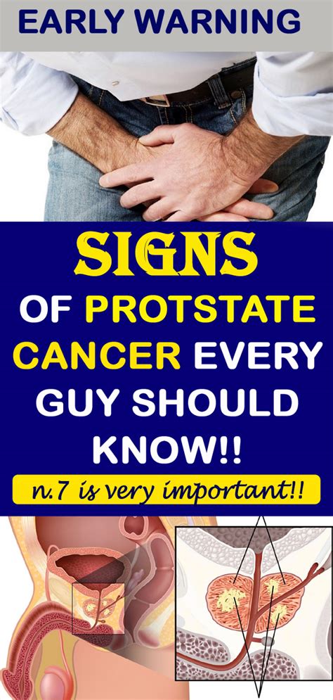 12 Early Warning Signs Of Prostate Cancer That Every Guy Needs To Know World Of Health