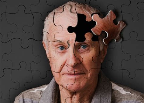 Conhecendo A Doença De Alzheimer Envelheci E Agora