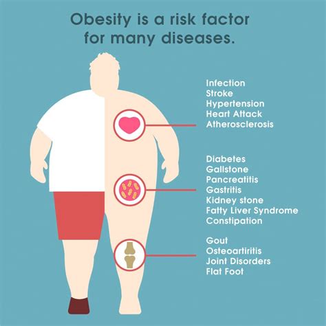 What Is Obesity The Best Way To Lose The Weight June 2022