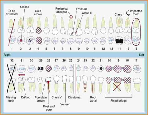 Dental Charting Dental Charting Dental Hygiene Student Dental
