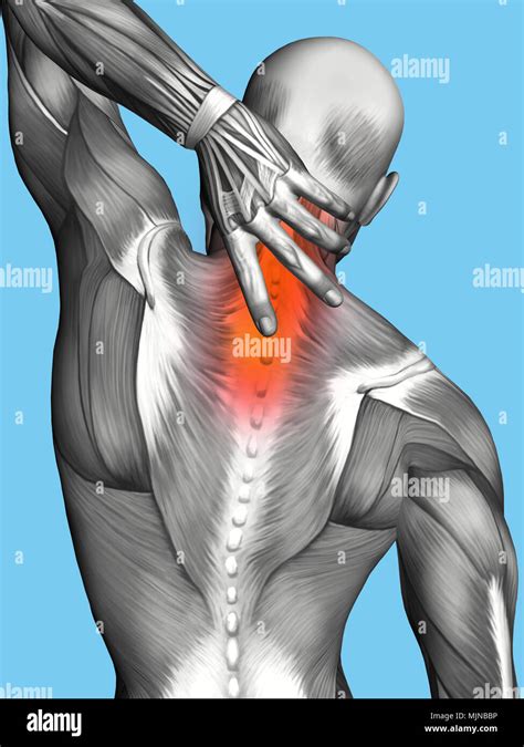 Upper Back Muscles Pain