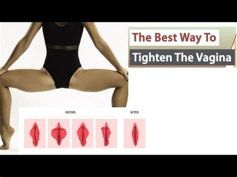 How To Get A Tighter Vagina Without Surgery At Home Youtube