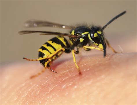 Wasp Sting What To Do And Remedies Against Swelling