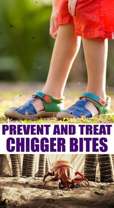 You Will Find Almost 50 Different Ways To Prevent And Treat Chigger